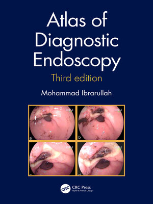 cover image of Atlas of Diagnostic Endoscopy, 3E